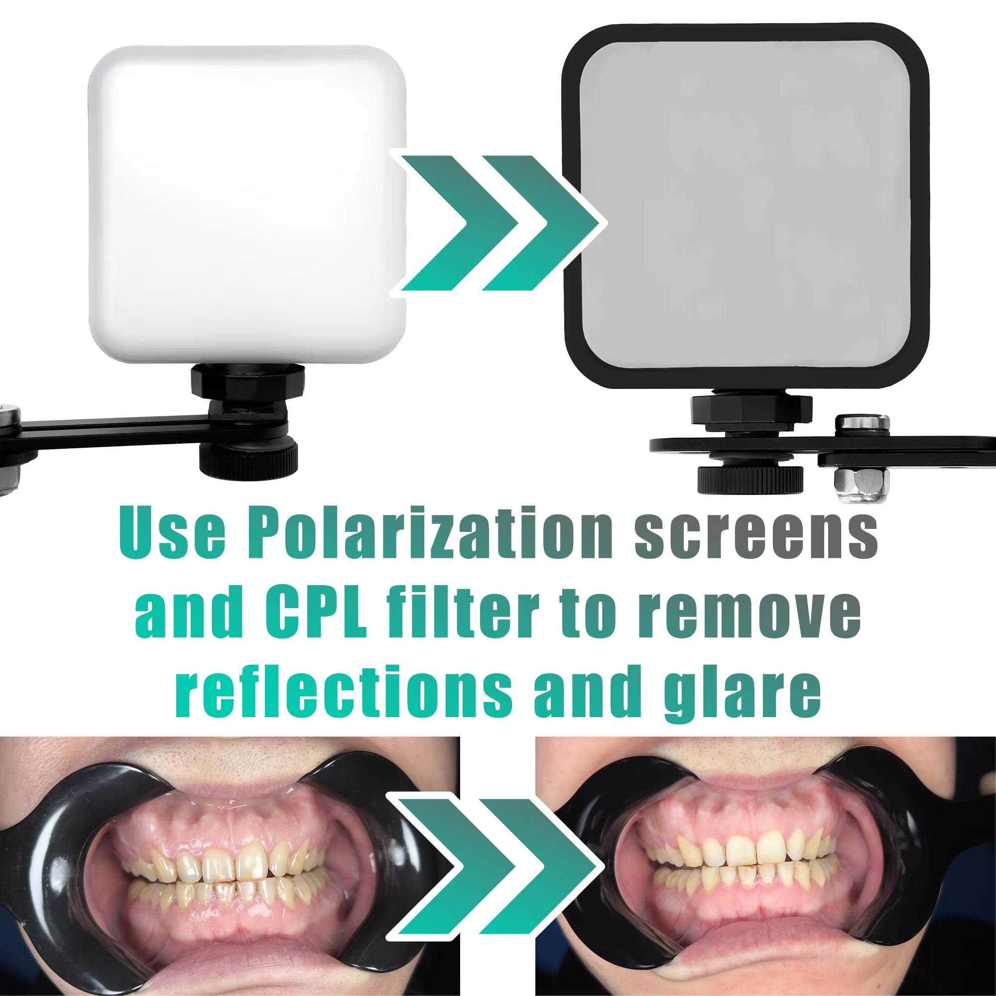 Adjustable Dental Photo Light  - Photography Lighting Essentials ulasan dan harga